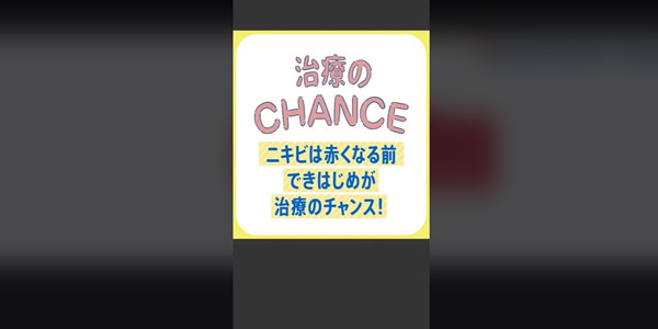 ニキビができにくい肌を目指せるって本当？